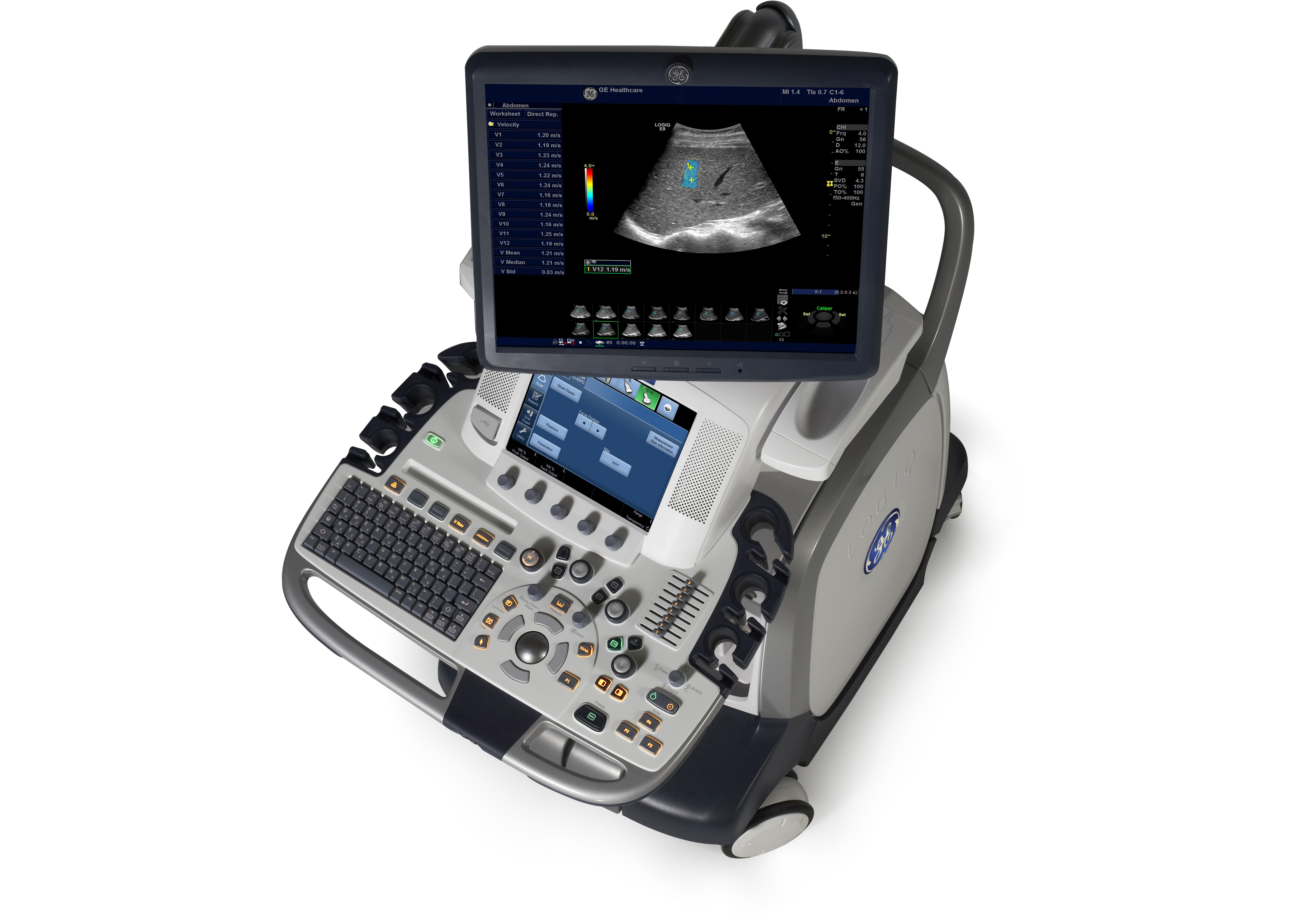 Shear genius New ultrasound technology helps clinicians instantly